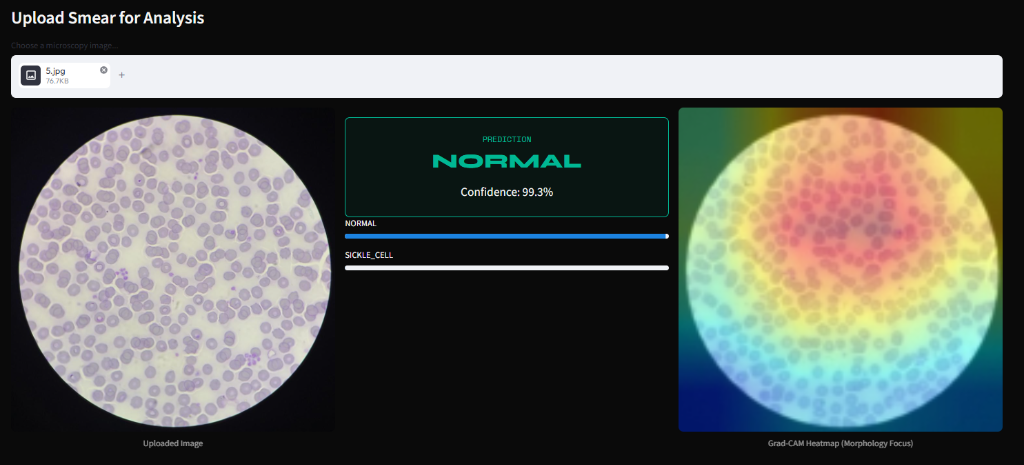 Normal blood cell prediction screen