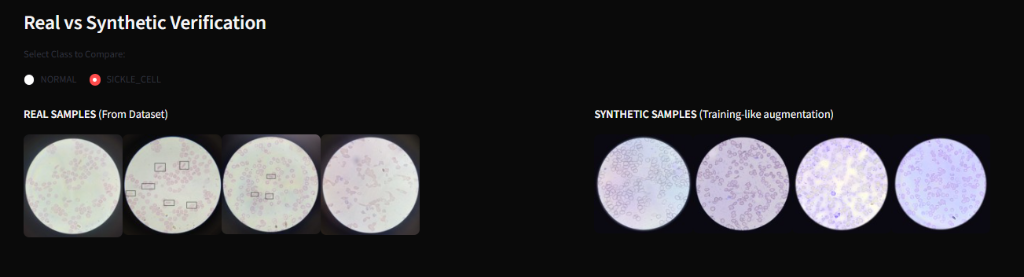 Verify sickle cell comparison